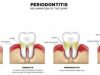 Su ortodontiniu gydymu susijusi rizika