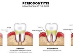 Su ortodontiniu gydymu susijusi rizika