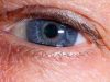 Paradoksas: sausas akis gydantys lašai jas gali dar labiau išsausinti