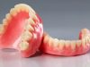 Dantų protezavimas Šiauliuose: kurią kliniką pasirinkti?