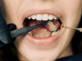 Kaip rasti gerą ortodontą?