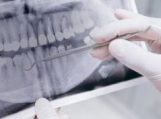 Dantų protezai: kokią galimybę pasirinkti?